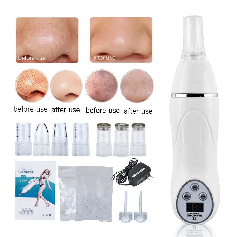 Diamond Microdermabrasion Machine – At-Home Facial Skin Resurfacing Device
